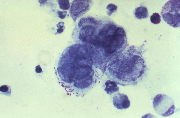 Microscopic View of Herpes, an STI.